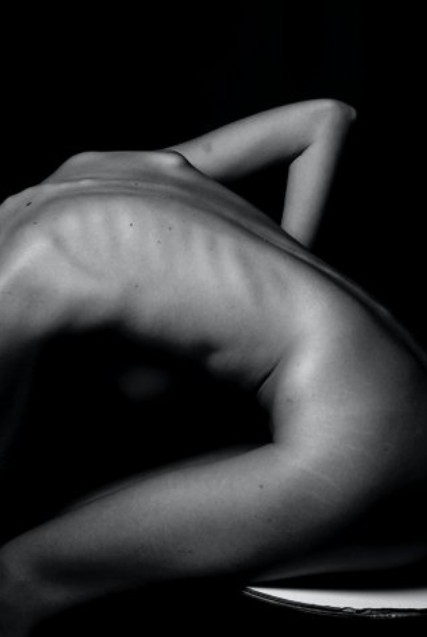 Stress Urinary Incontinence – It May Be All In The Hips