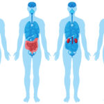 What Happens When My Organs Are Stuck Together?