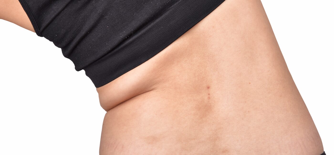 GLP-1 Medications and Bloating: Why You Feel Distended (and What Actually Helps)